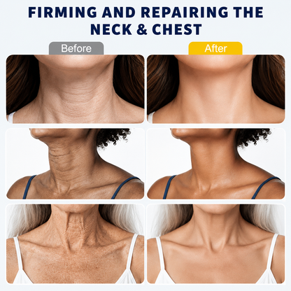 ✨ Instant Neck Lift Cream — 🧴 Infused with Retinol & Hyaluronic Acid | Firms the Neck, Reduces Wrinkles & Double Chin